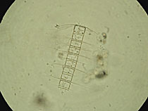 �v�����N�g���P